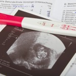 Ultraschallbild Schwangerschaftstest Mutterpass