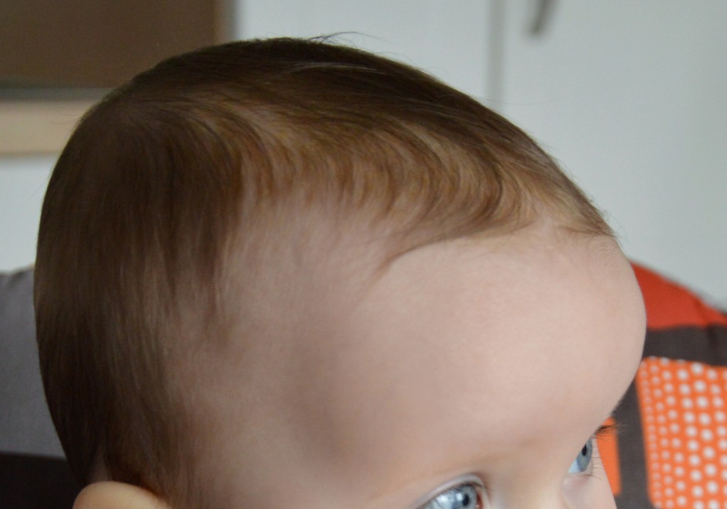 Kleine Pickel Rote Haut Wenn Das Baby Hautausschlag Hat Mibaby Magazin Ratgeber Testberichte Fur Eltern