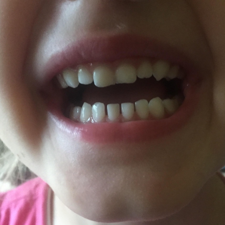 Miss Denti mit Schnullerbox